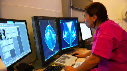 谷歌AI系统乳腺癌检测取得新突破，准确率胜过人类专家